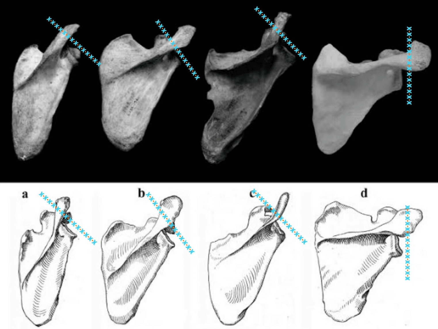 Comparación de escápulas de primates